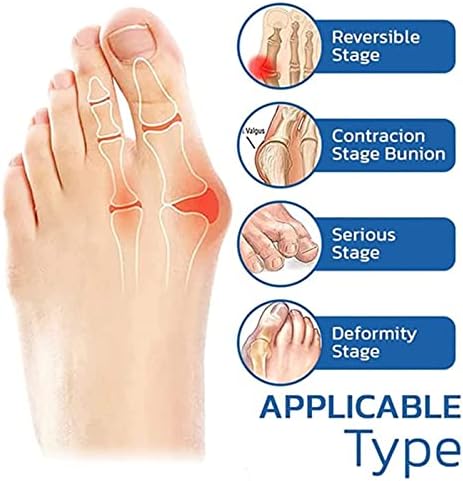 Ортопедични Чорапи за Улесняване на палеца на Крака, Дамски Ортопедични Компресия Чорапи за краката, Чорапи за Изравняване на Чорап за Палеца на Крака, за Мъже и Жени